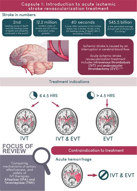 Role of TPA in Stroke Treatment