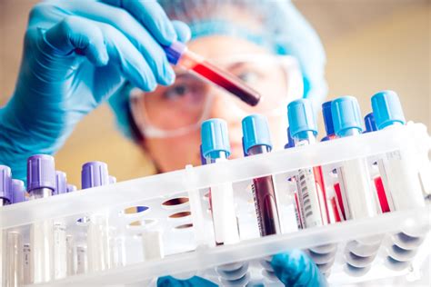 Testing and Diagnosis