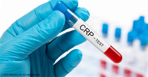 C-Reactive Protein (CRP) Test