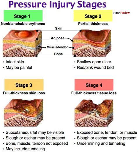 [How-To] How To Accurately Staging Pressure Injuries Using Up-To-Date Clinical Guidelines