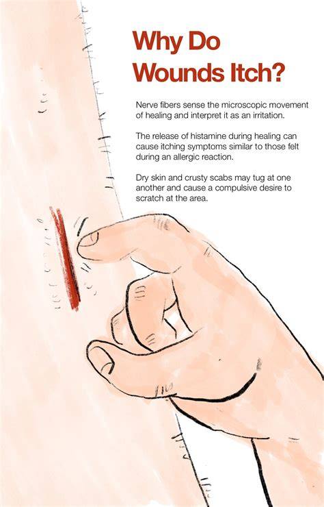 [Strategic Guide] Managing Incision Itching Safely Without Scratching Or Disrupting Scabs