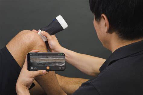 [Trend Analysis] Handheld Ultrasound Scanners Integrated With Real-Time Computer Vision Guidance
