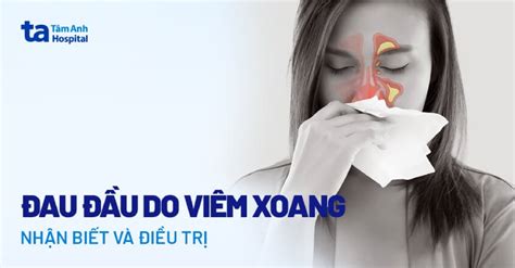 đau đầu viêm xoang