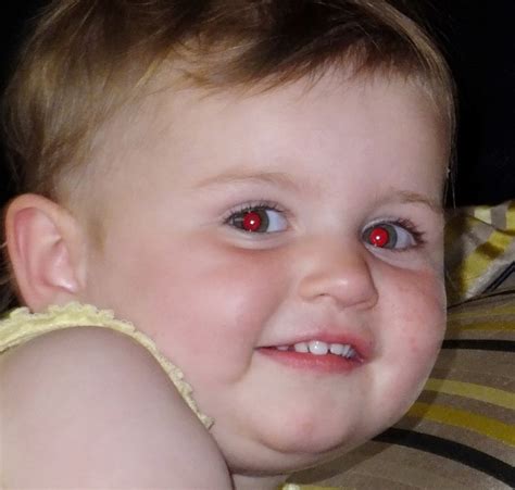 صورة طفل عين حمراء