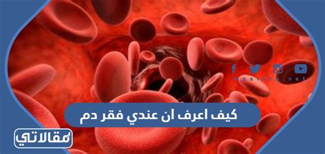 كيفية التعرف على الأعراض الشائعة لفقر الدم