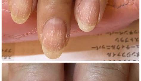 【ジェルネイルオフ後】爪に付いた白い傷を取る方法 YouTube