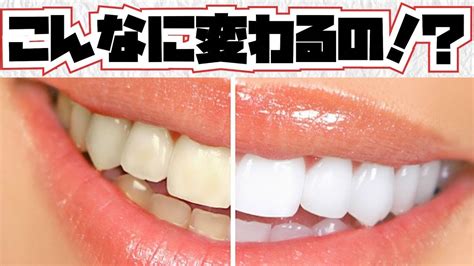 【知っトク】誰の家にでもあるもので「歯を白くする方法」がこちら！ YouTube