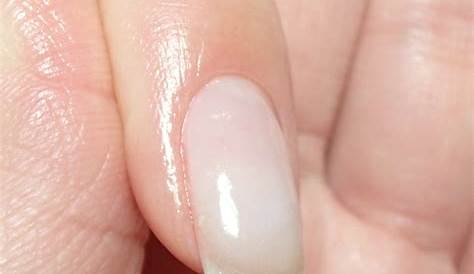 爪 ネイル 伸びてきた部分 のピンク部分が指の先まで伸びていると何がいいんですか 育－素のままで美しいへ―