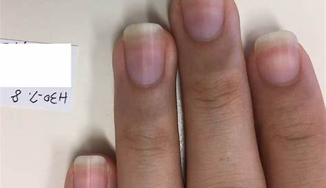 爪 ピンク色 白い が変色するのは病気？色別に考えられる原因や症状、治療法を紹介！ Hapila ハピラ