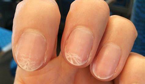 爪 白い 乾燥 が白くなってしまう3大原因と対処法｜マニキュア、ネイルカラー、ネイルケア