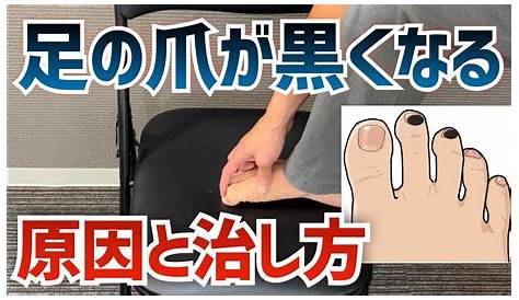 足の「黒爪」2つの原因と治し方 ｜京都市北区 もり鍼灸整骨院 YouTube