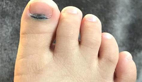 足 親指 爪 黒い 点 の指のに斑が。 こんばんは。 ののの中に3ヶ月前からに OKWAVE