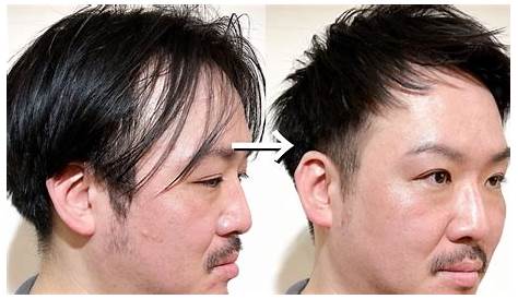 M字ハゲを自然に隠す髪型16選！男の薄毛を熟知した美容師のヘアカタログ｜AGA+ [エージーエープラス] メンズ ヘアスタイル, はげ