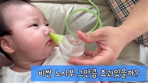 노시부 프로 전동식 의료용 아기 콧물흡입기