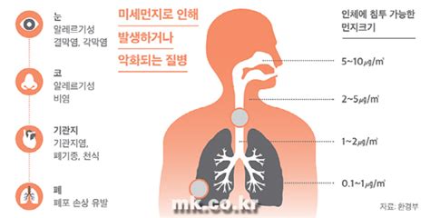 미세먼지 기관지 질병 폐기종