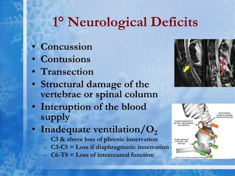 neurological deficits