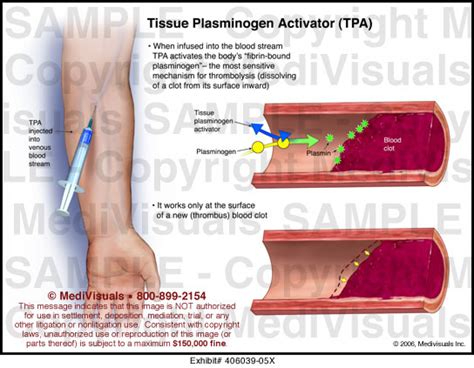 tissue plasminogen activator (tPA)