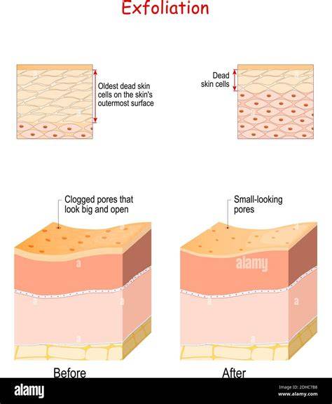 Exfoliating Dead Skin Cells