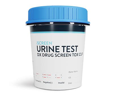 Factors to Consider When Choosing a Urine Drug Screen Lab