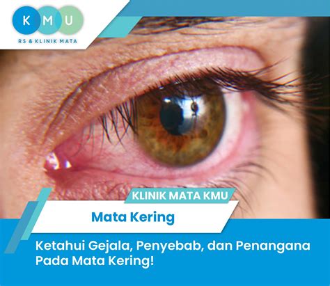 Mata Kering
