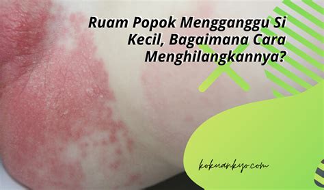 Ruam popok