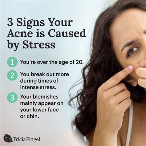 Stress and Acne
