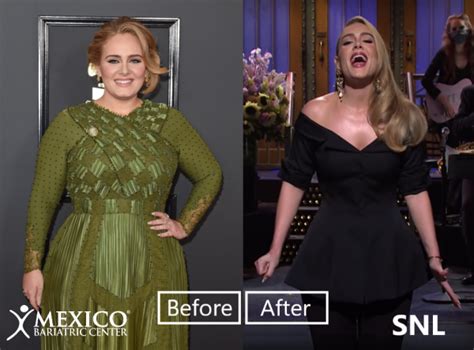 Adele Weight Loss Bariatric Surgery