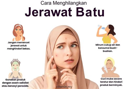 faq+tentang +jerawat+batu
