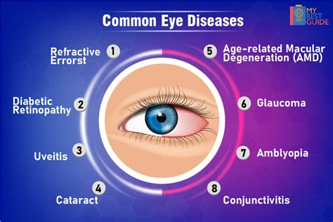 treatments for eye diseases and conditions