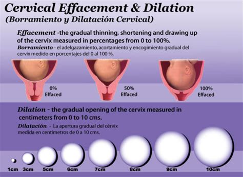 1 1 2 cm dilated 50 effaced