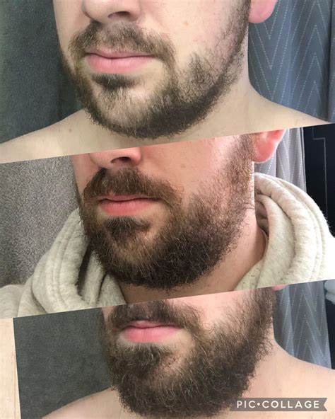1 Month Beard