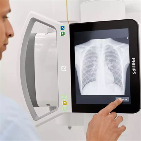 1. Improved picture quality