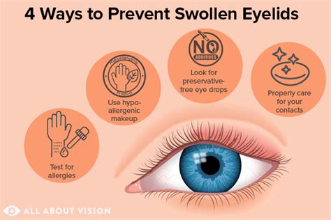 10 Essential Tips for Treating Swollen Eyes Upon Waking