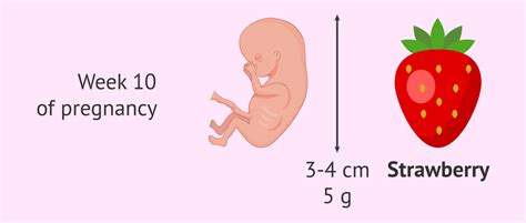 What to Expect at 10 Weeks Gestation: A Guide to Pregnancy Symptoms and Development