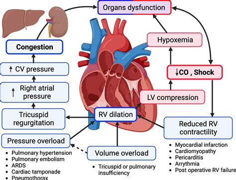 10. Unlocking the Right Ventricle: Functions and Disorders Explained