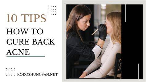 Back Acne