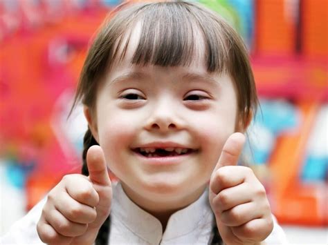 11 Fakta Tentang Down Syndrome
