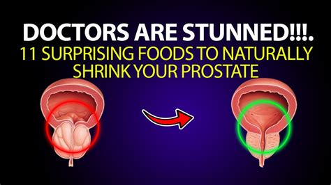 11 Effective Methods to Naturally Shrink Your Prostate Fast