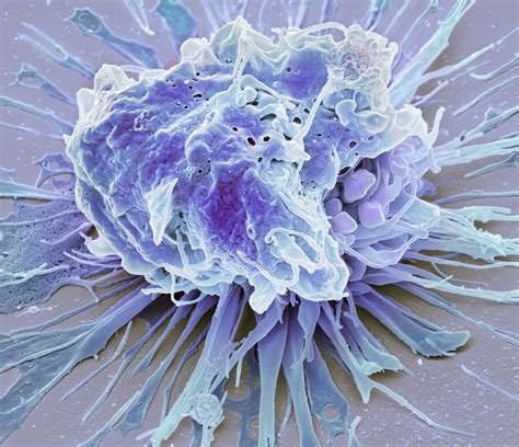 11 Essential Signs of Cancer Cell Death You Must Recognize