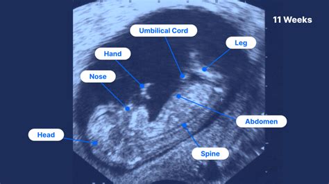 11 Essential Tips for Fostering Fetal Development at 11 Weeks