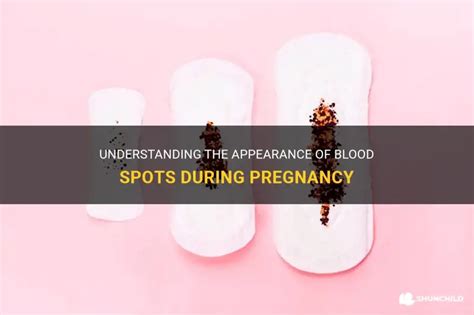 11 Essential Tips to Recognize Normal Pregnancy Blood Spots