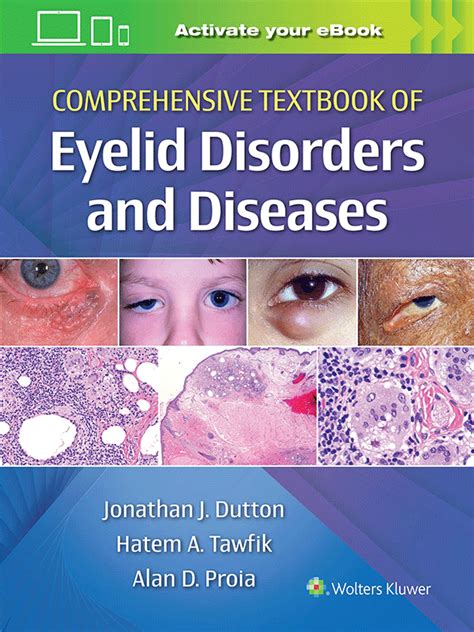 11 Eyelid Disorders: Comprehensive Guide to Function & Pathology.