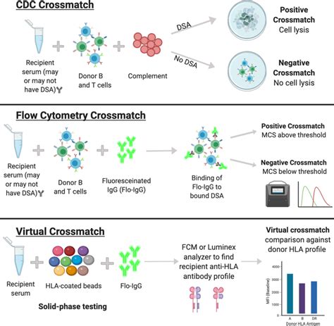 12 Crossmatch Testing: Protocols, Significance, and Clinical Implementation.