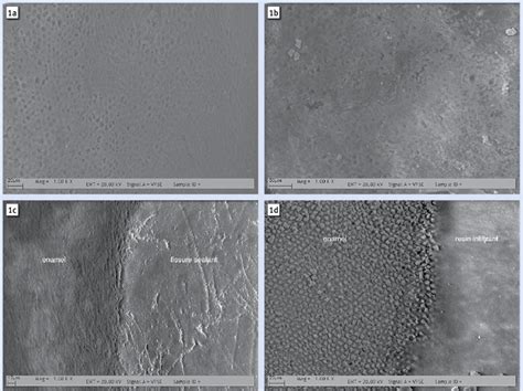 Unveil Deep Insights: 12 Microscope Views That Will Blow Your Mind