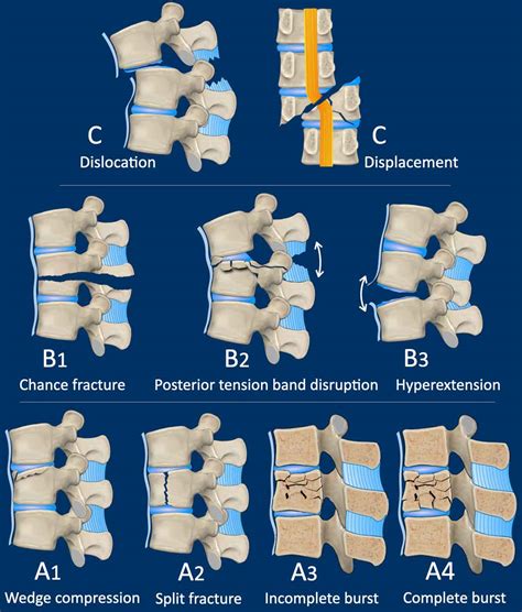 12. Distract with pattern