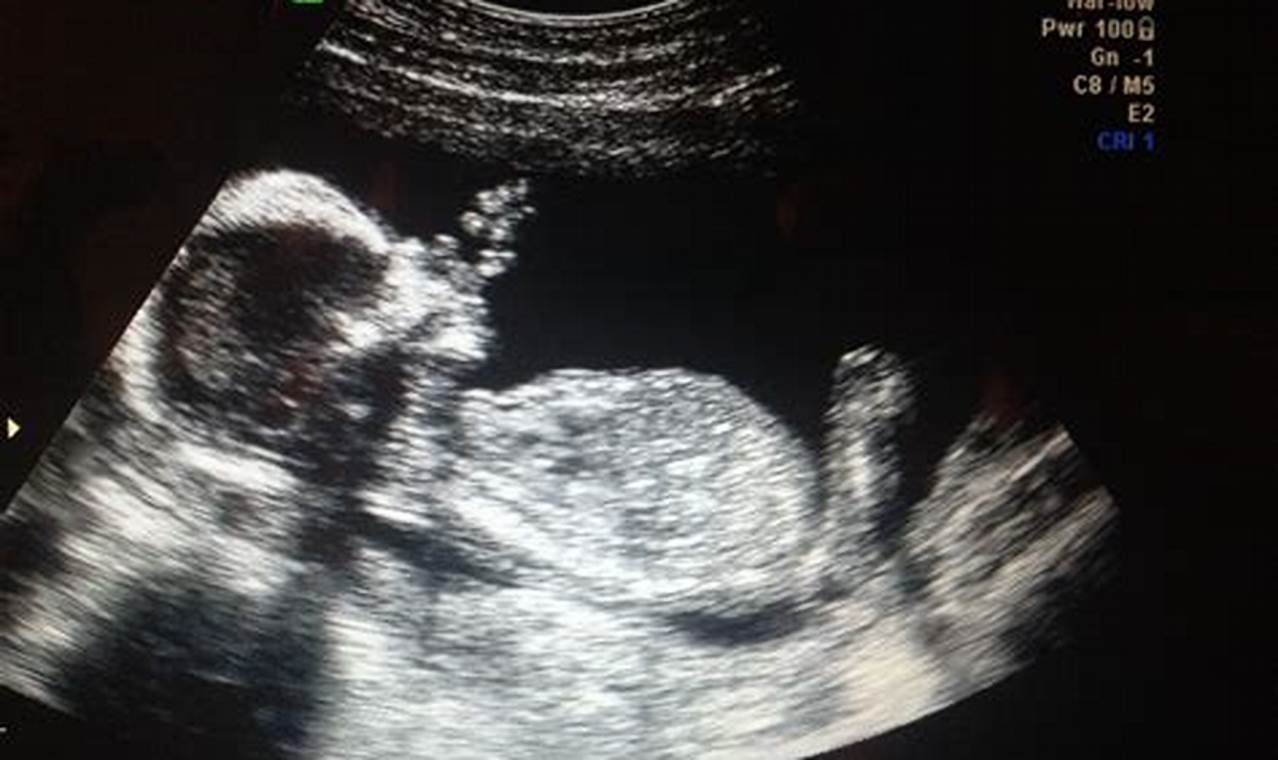 Witness Your Baby's World with a 15 Weeks Pregnant 4D Ultrasound