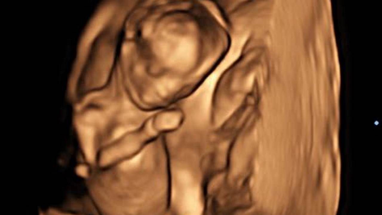 Prepare for Your 15-Week Ultrasound: A Detailed Guide to Fetal Development