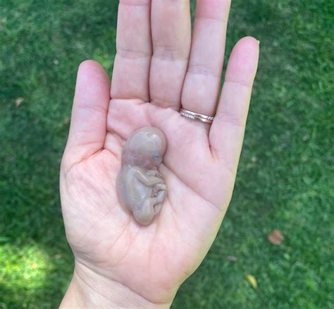 2 weeks miscarriage images