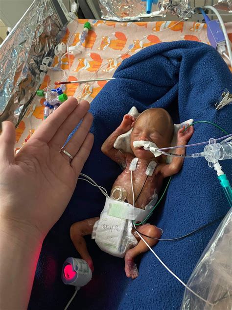 What Does a 22 Week Fetus Look Like Inside?