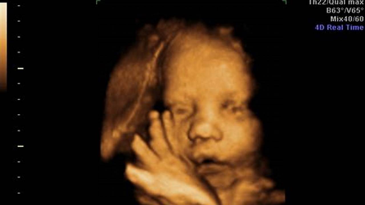 Unforgettable Bonding: Your Guide to 28 Weeks Pregnant 3D Ultrasound